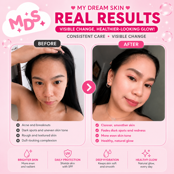 MDS Facial Products